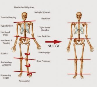 SLGL.NUCCA SLGL.NUCCA
